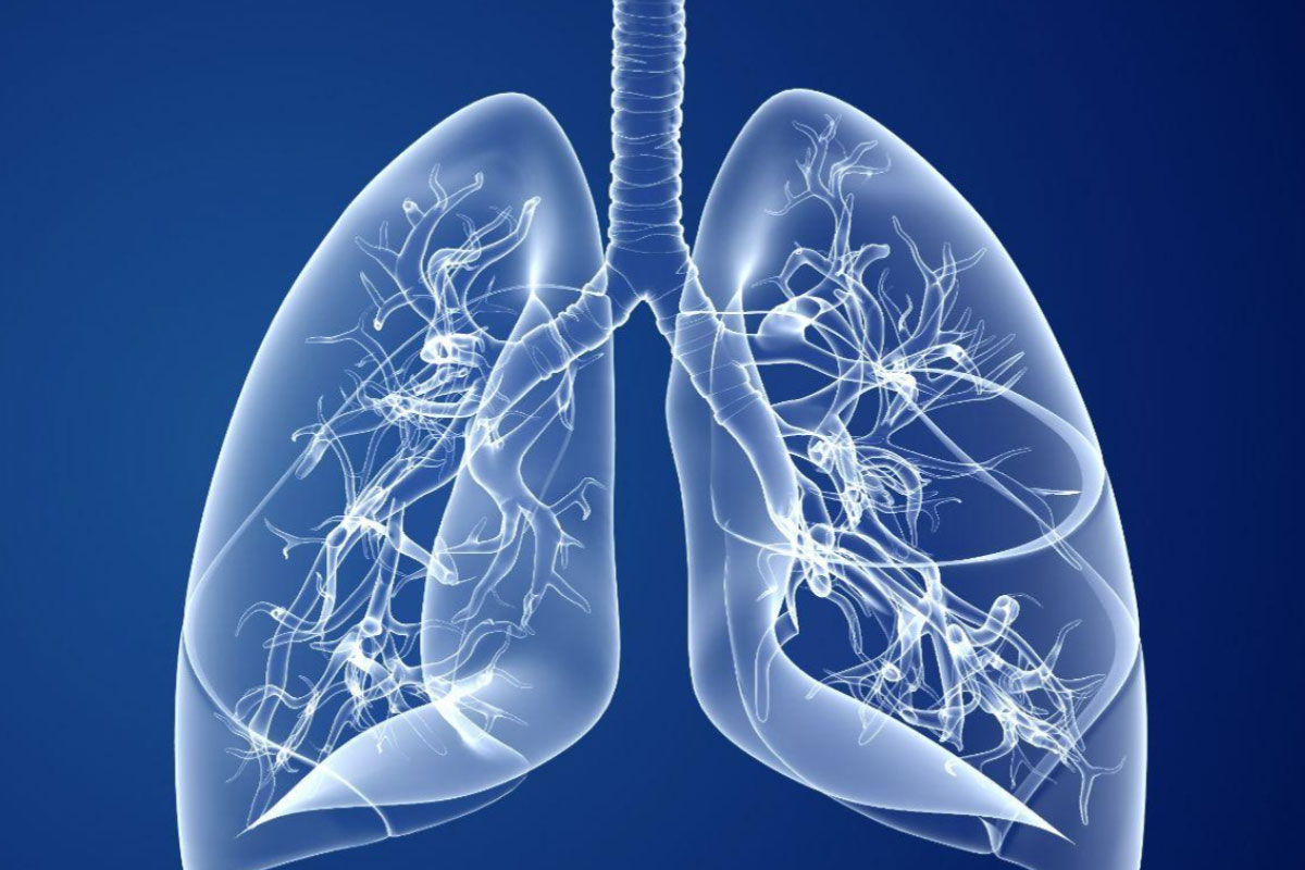 Adventist Health Glendale Reaches Clinical Milestone With First Successful Airway Y-Stent Placement Procedure